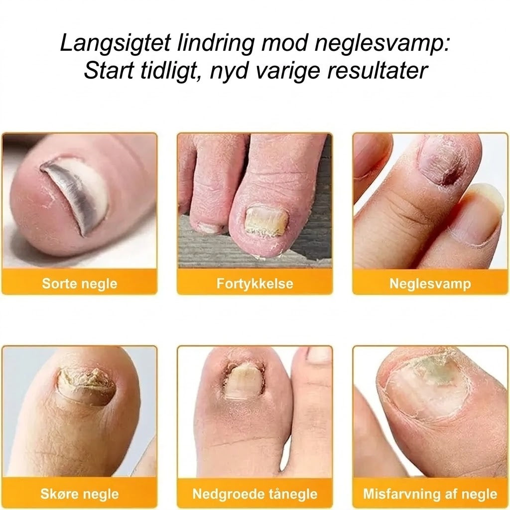 SilkEase™ Svampedræbende Negleplastre & Plejesæt