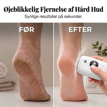 Automatisk Elektrisk Fodfil | Effektiv Hårdhudsfjerner til Hjemmebrug