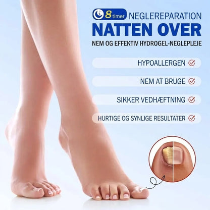 SilkEase™ Svampedræbende Negleplastre & Plejesæt