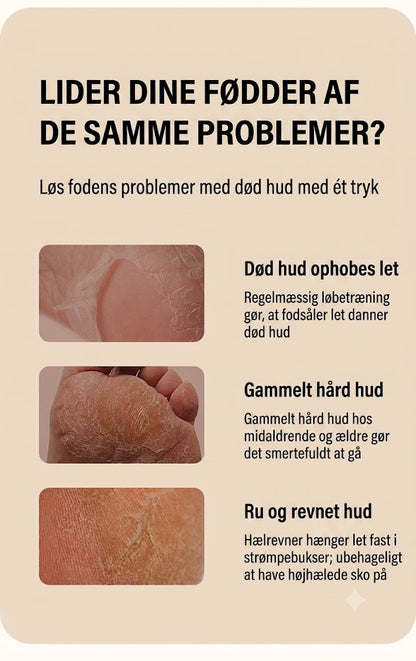 [KØB 1 FÅ 1 GRATIS] SilkEase™ Opgraderet Elektrisk Hård Hud Fjerner | Genopladelig Fodfil